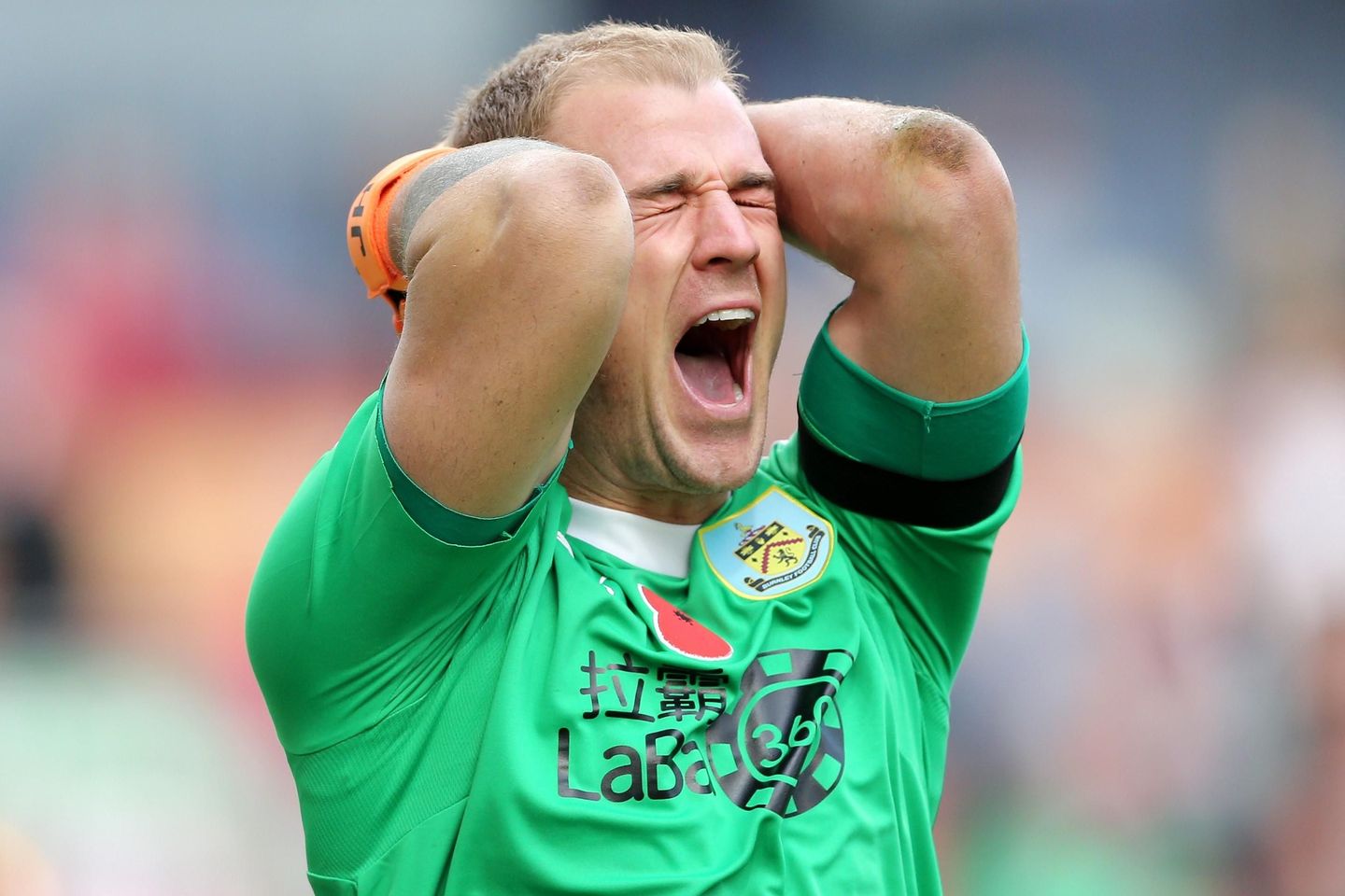 Joe Hart of Burnley reacts