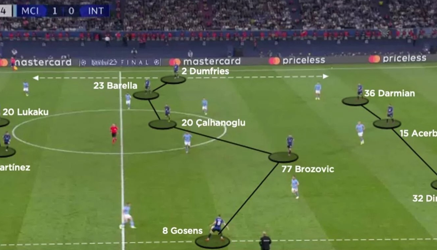 CV MCI INT UCL