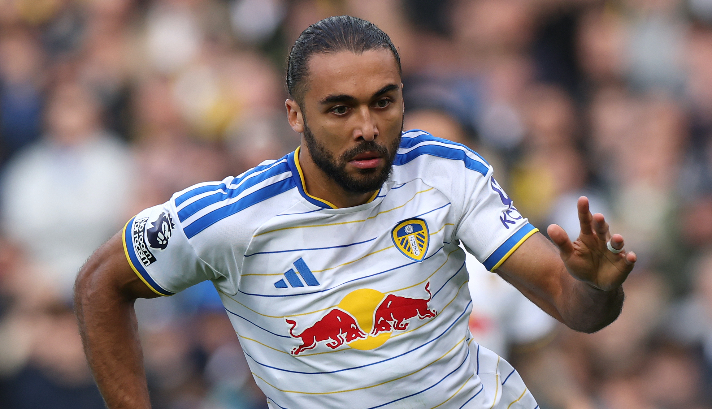 Calvert-Lewin a doubt to face Sunderland - see Farke's update